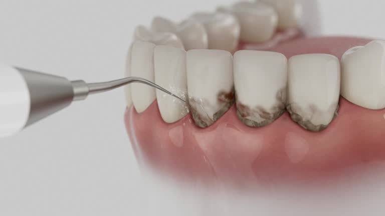 Reliable Dental contractor in Durham, OR by Smile Center Dentistry